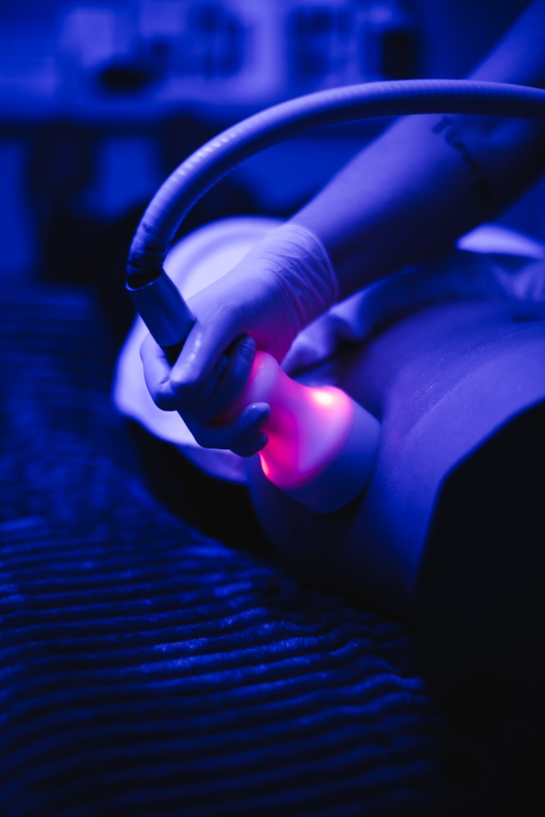 iCRYO Clemson Cryosculpting body sculpting session