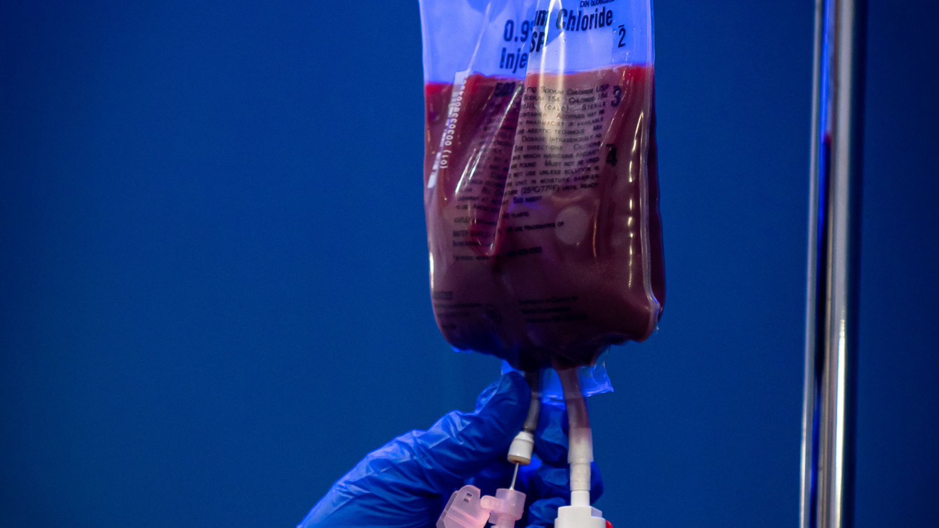 Ozone UV IV therapy treatment for immune support and cellular health